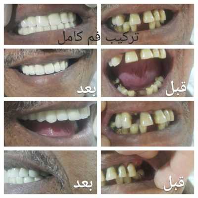 Images